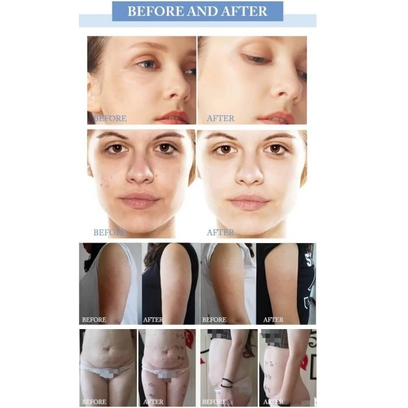 Dr.-Beauty-medizin-Negativdruckroller-Physiotherapie-Massagegeraet-Vacuum-Laser-Testsieger