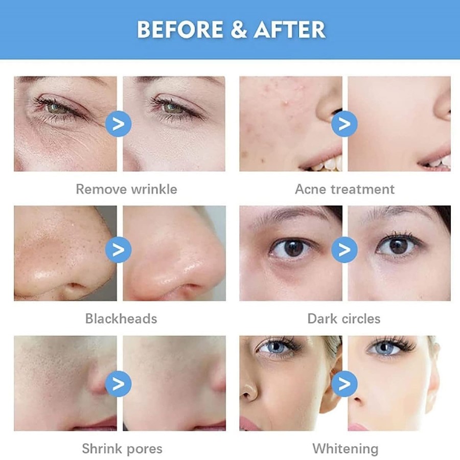 Dr.Beauty-medizinisches-professionelles-Wasser-Sauerstoff-Smart-Ice-Blue-Jet-Peel-Hautverjuengungsgeraet-3