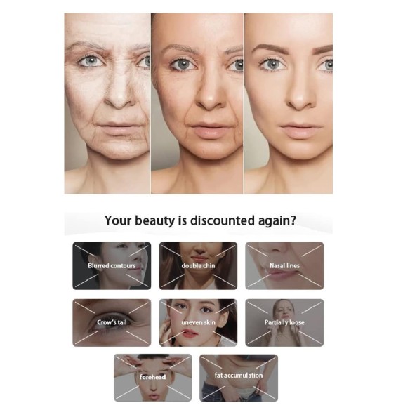 Dr.Beauty-medizinische-professionelle-schmerzfreie-Radiofrequenz-Anti-Aging-Anti-Falten-Schoenheitsmaschine-6